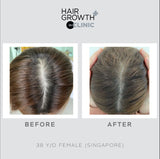 Nourkrin® Hair Growth+ inCLINIC (4)