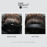 Nourkrin® Hair Growth+ inCLINIC (5)